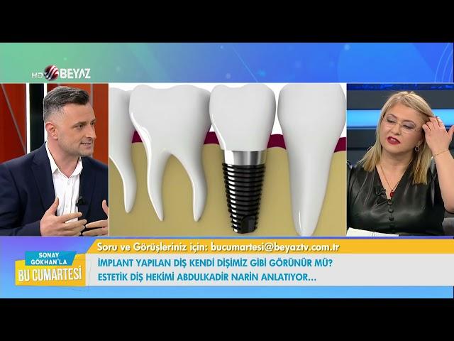 Bir günde implant Estetik Diş Hekimi Abdulkadir Narin