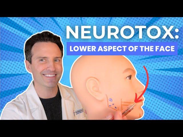 Neurotoxins: Lower Aspect of the Face