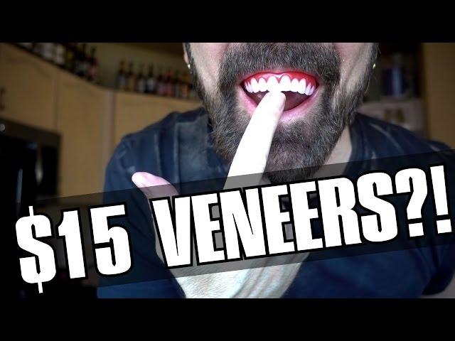 Perfect Smile Veneers Review: $15 Veneers?