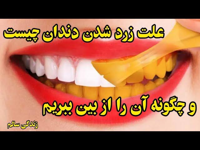 علت زرد شدن دندان چیست:وچگونه آن را ازبین ببریم؟