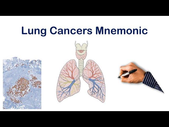 Lung Cancer Types Mnemonic | USMLE STEP COMLEX NCLEX