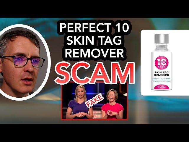 Perfect 10 or 'Bliss Skin' Skin Tag Remover 'Shark Tank' Scam and Reviews, Explained