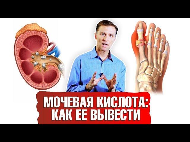 Мочевая кислота. Как вывести ее из организма? ️