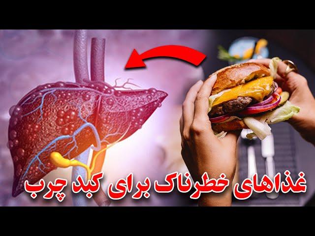 لیست غذاهای مضر و خطرناک برای کبد چرب