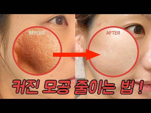 피부좋아지는법 이것만 따라해주세요! 모공줄이는법 성분추천 (알려주기 아까운 피부 관리법)