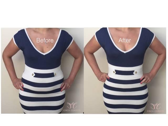 Cinch waist training Corsets before and after and media reviews