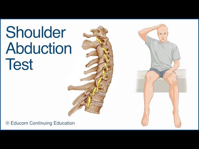 Shoulder Abduction Test - A Chiropractic Online CE™ Production