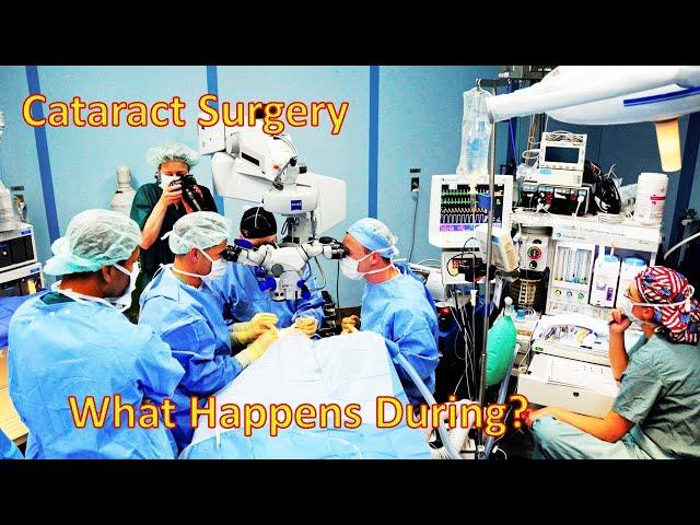 Cataract Surgeries-What Happens During (2/4)(4K)