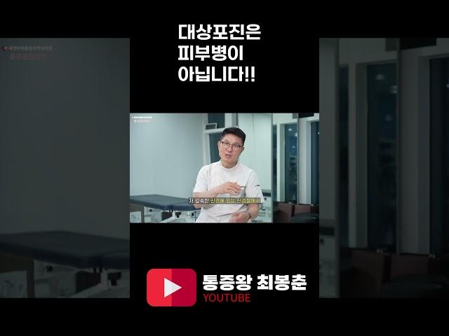 대상포진은 피부병이 아닙니다.
