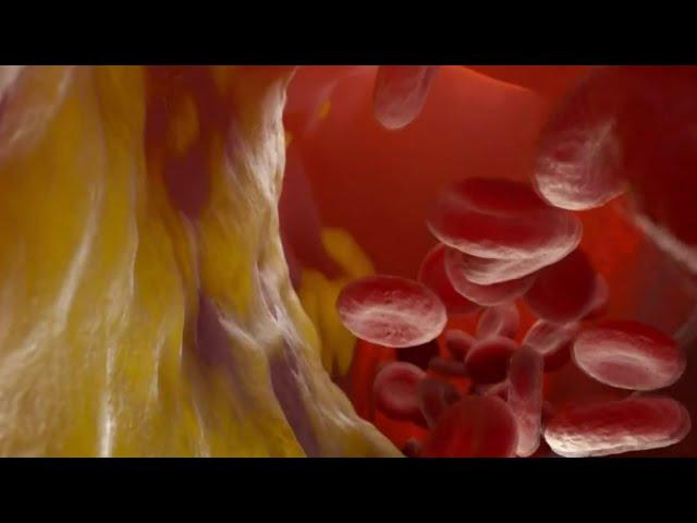 Busting common cholesterol myths