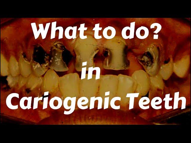 What To Do In Cariogenic Teeth? Dental Caries Treatment || Stop Dental Caries? Best Filling Material