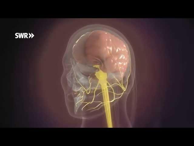 Physiologie: Migräne-Anfall | SWR Wissen