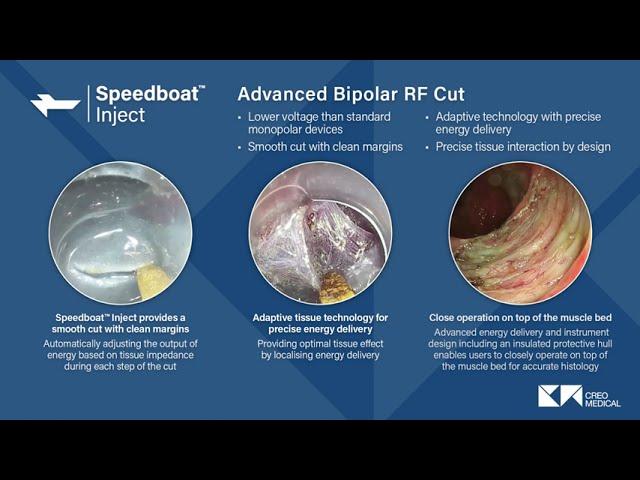 Speedboat: 5-in-1 features for submucosal dissection