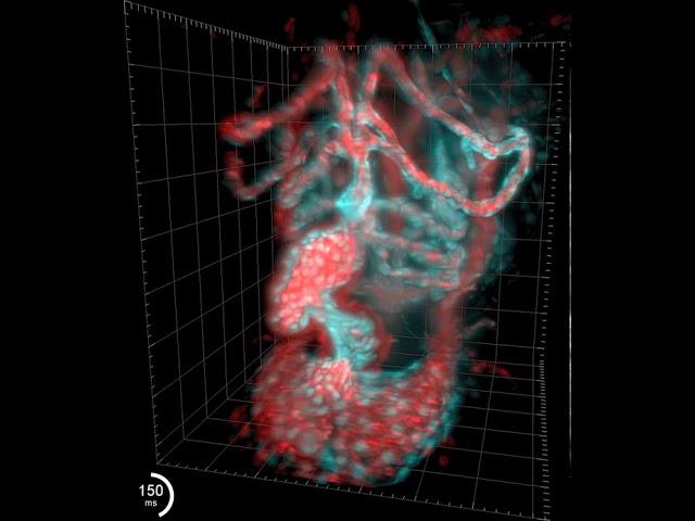 Beating Zebrafish Heart by Michael Weber