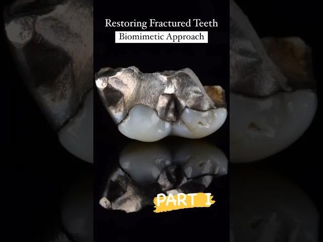  Restoring Fractured Teeth with a Biomimetic Approach! 