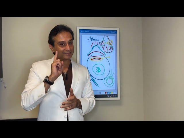 What is Keratoconus and what Treatments are available? Dr. Gulani explains