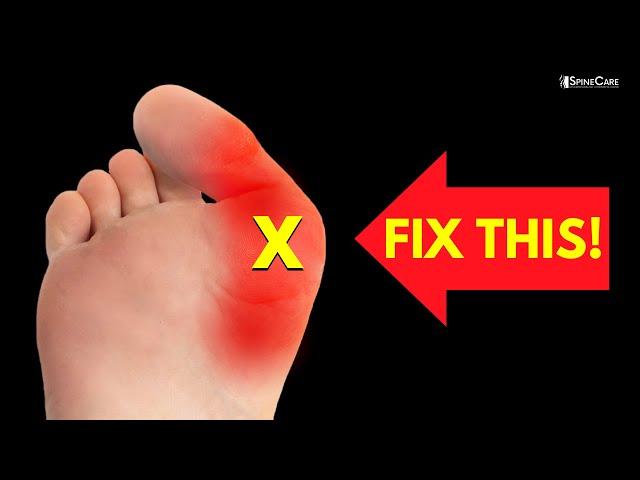 How to Relieve Bunion Pain at Home (NO EQUIPMENT!)