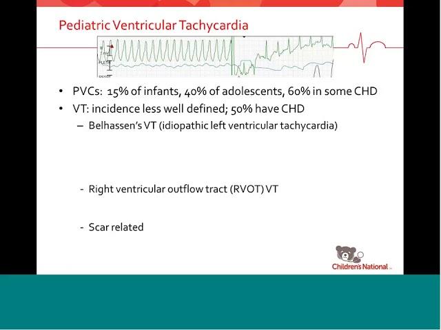 Arrhythmias in kids