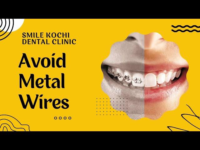 Metal-Free Transparent Aligners at Smile Kochi Dental Clinic | Kadavanthara | Palarivattom