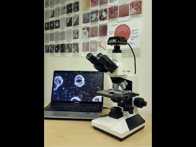 2017 11 14 17 09 The importance of choosing the right microscope for LBA