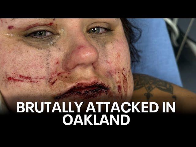 Oakland woman brutally attacked by group of young people | KTVU