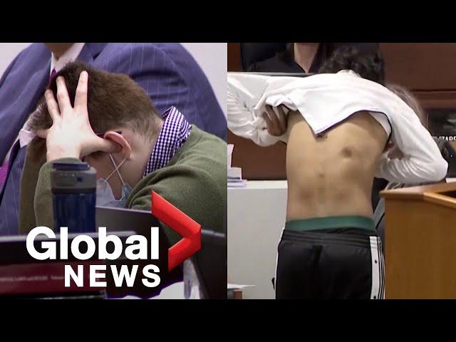 Nikolas Cruz trial: Parkland school shooting survivor shows scars from bullet wounds