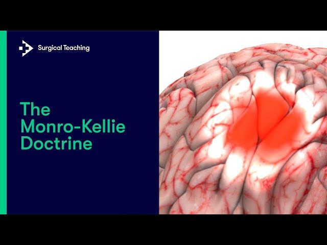 What is the Monro-Kellie Doctrine?