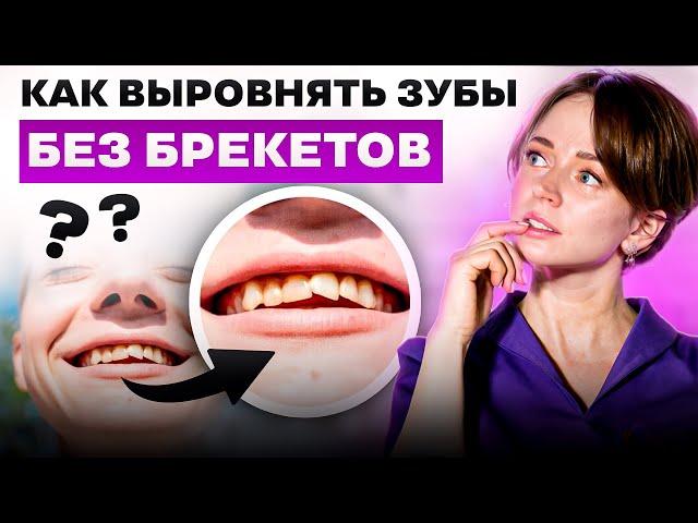 КАК ВЫРОВНЯТЬ ЗУБЫ БЕЗ БРЕКЕТОВ? (ПРИ ПОМОЩИ КОРОНОК И ВИНИРОВ)