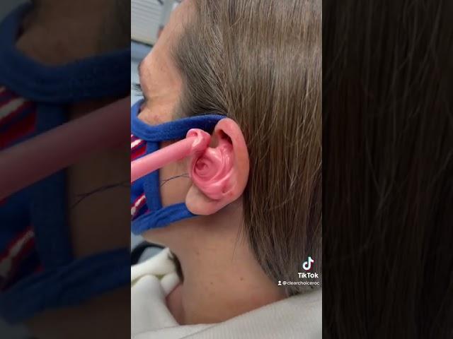 #billsmafia for the win  #earimpression #satisfying #earwax #audiologist #audiology #earwaxremoval