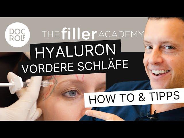 Der beste Weg die VORDERE SCHLÄFE mit HYALURON zu unterspritzen – TFA by doc.rolf