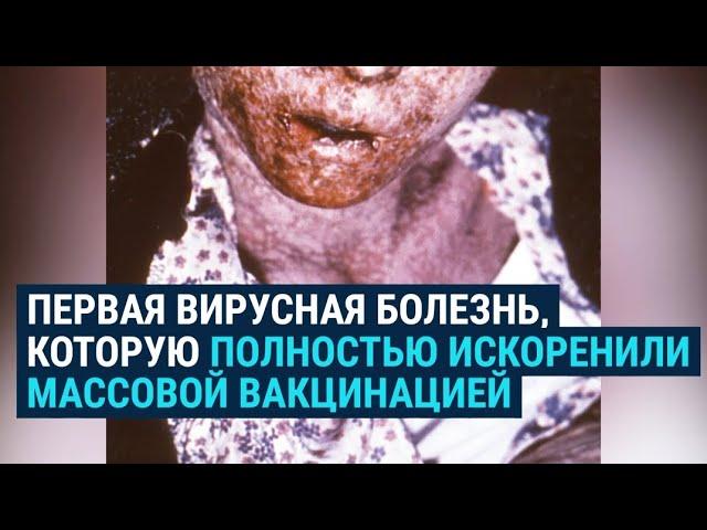 Как победили оспу при помощи вакцины