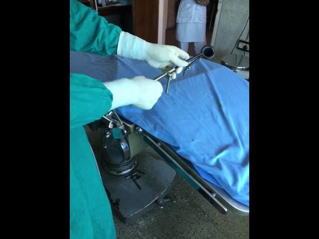 Table speculum holder for stapes surgery - Dr.Suri Prabhu