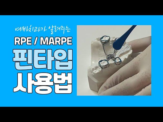 예바치과가 알려주는 RPE/MARPE Pin Type 올바른 사용법