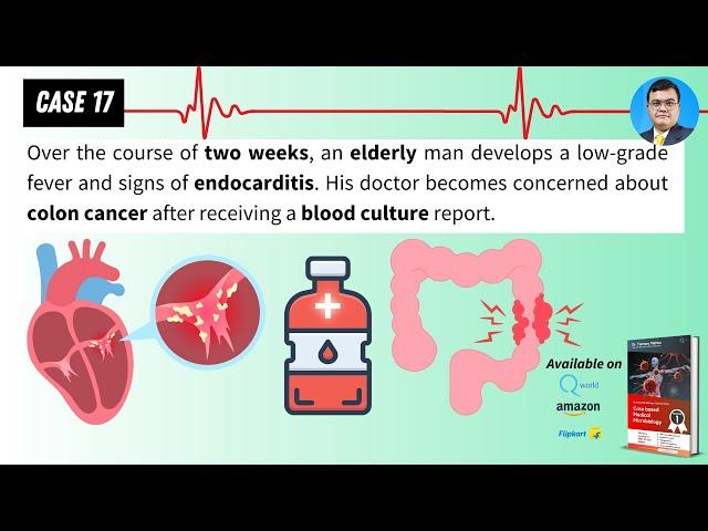 Case based Medical Microbiology Tutorials: Case 17: Endocarditis with risk of colon cancer