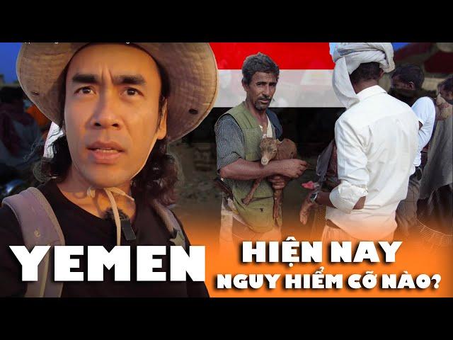 Yemen: Cuộc sống ở quốc gia còn chiến tranh này hiện nay ra sao? 