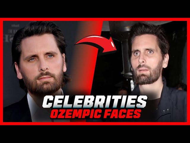 Ozempic Face Has Taken Over Hollywood | Celebrity Secrets REVEALED!