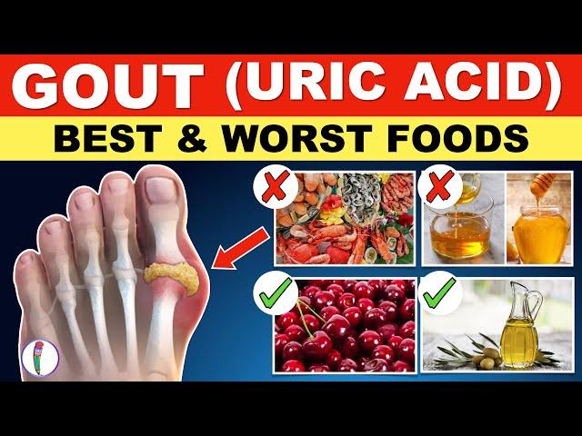 Uric acid Foods to Avoid | Gout Diet Meal Plan | Gout | Uric acid - Best & Worst Foods