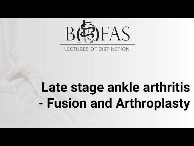 Late Stage Ankle Arthritis - Fusion & Arthroplasty - BOFAS Lectures of Distinction