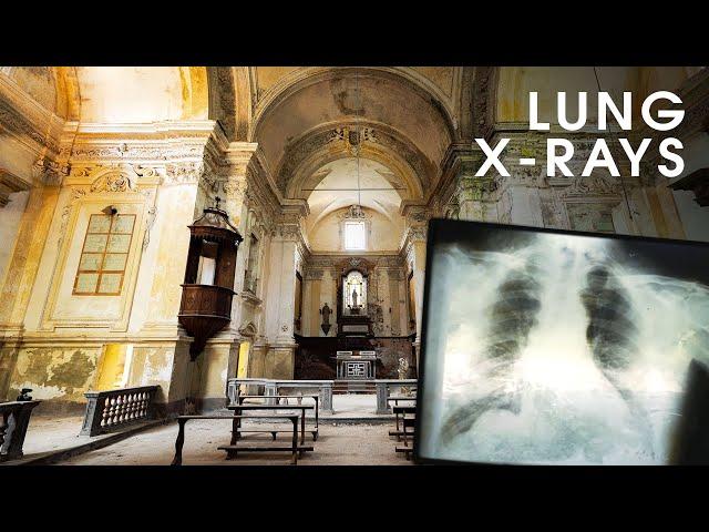 Huge Abandoned Monastery - Filled with Tuberculosis X-Rays!