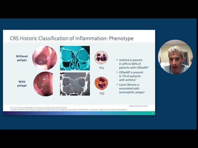 Rhinosinusitis With Nasal Polyps: From Pathophysiology to Management