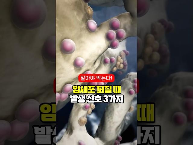 암세포 퍼질 때 나타나는 신호 3가지
