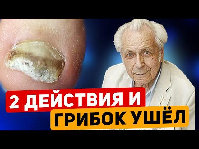 Неумывакин: ЭТОТ ПРОСТОЙ РЕЦЕПТ избавит от ГРИБКА - навсегда!