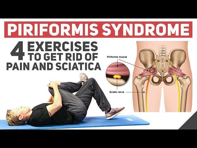 Piriformis Syndrome - Home Stretches & Exercises