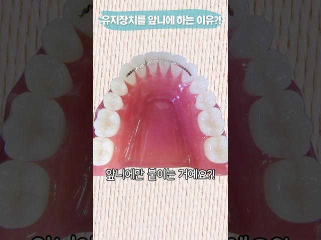 유지 장치는 왜 앞니에만 붙이죠? #shorts