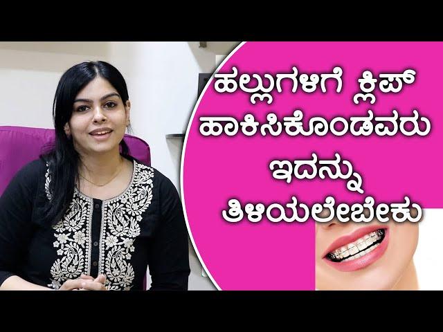 How Do Braces Work to Straighten Your Teeth? | Vijay Karnataka