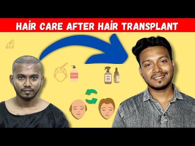 HAIR CARE AFTER HAIR SURGARY,For long term ,My Experience 2k24#hairtransplant