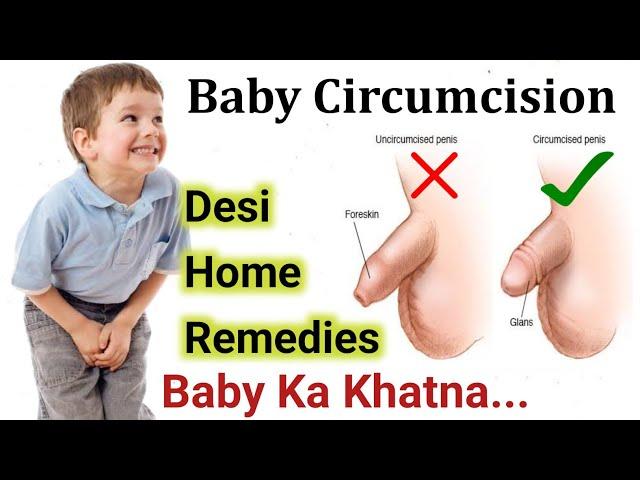 Baby Boy Circumcision | Bache Ka Khatna Home Remedies & Desi Tips | Newborn Baby Milestones