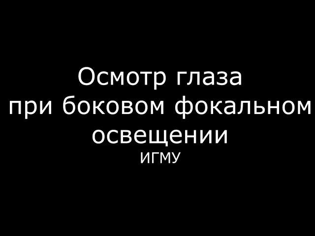 Осмотр глаза при боковом фокальном освещении - meduniver.com