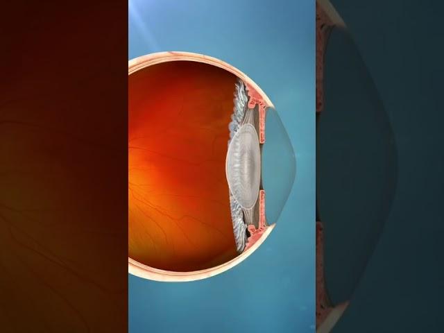 Human Eye  Lens Work