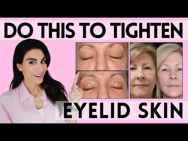 Eyelid Rejuvenation 101: Dermatologist Reveal Skin Tightening Treatments for the Eyes